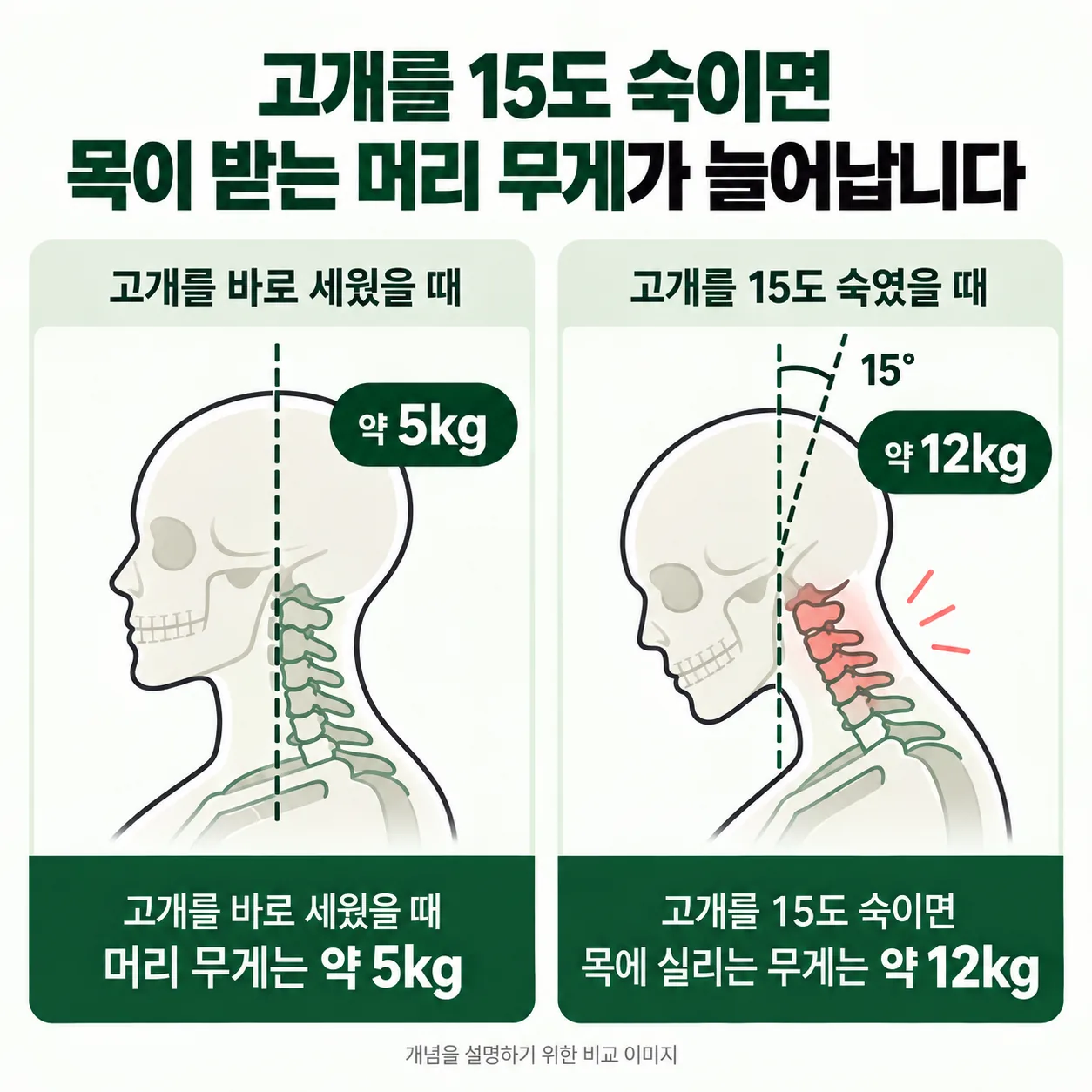 고개를 15도 숙였을 때 목이 받는 머리 무게가 늘어나는 개념도